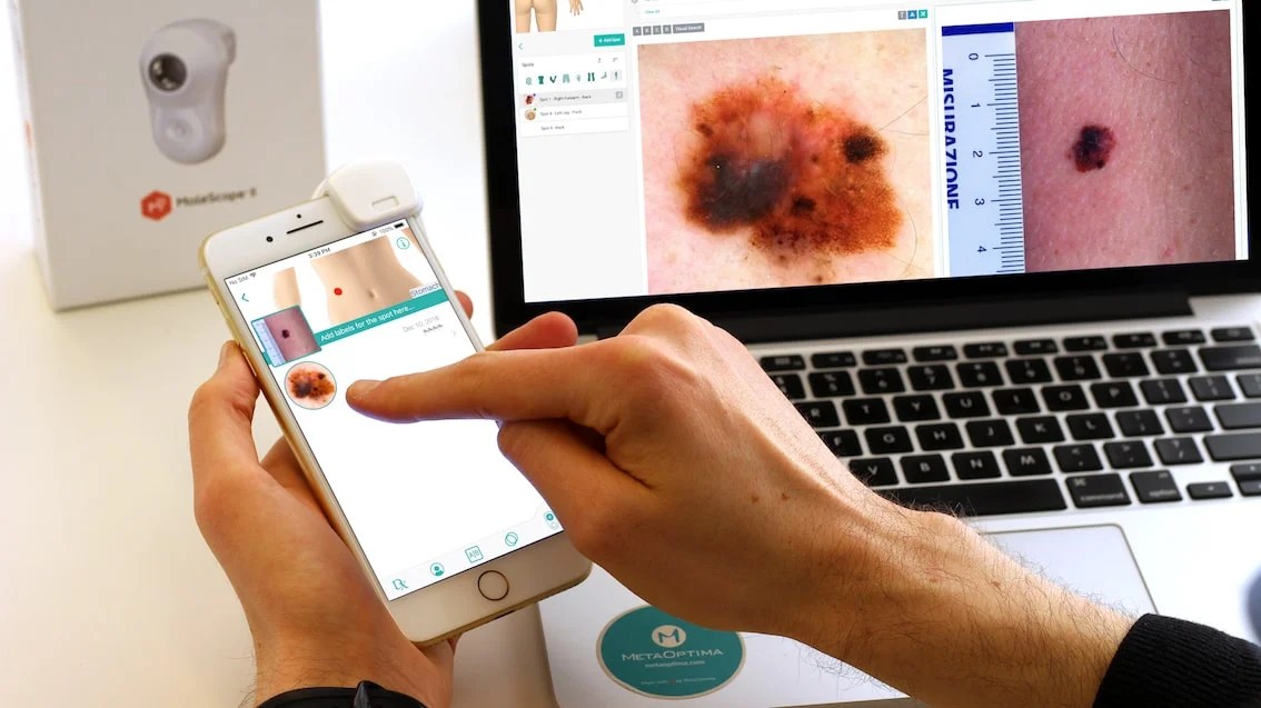 Teledermoscopy - Professional City Texture - 8K